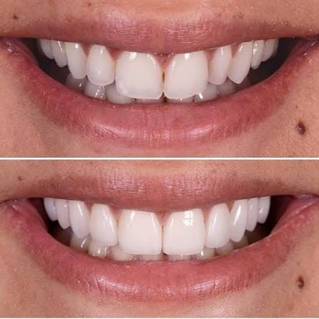 Happy Patient - Dental Care Center Uttam Nagar New Delhi